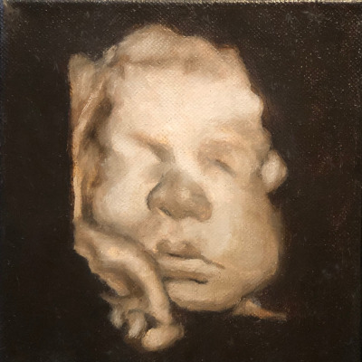 4D Sonogram to Canvas